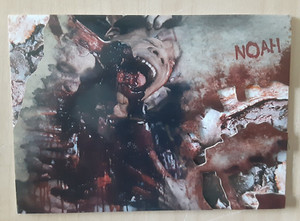 2016 Topps The Walking Dead Survival Box Walker Bite Noah #5 parallel card x/25