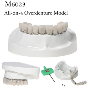 Dental Implant All-on-4 Overdenture Restoration Model Upper Jaw 4 Screws M6023 - Picture 1 of 13