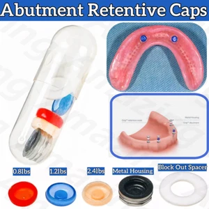 Localizador dental Pilares Tapas de retención Sistema de insertos de implantes Tapa de carcasa de metal - Imagen 1 de 9