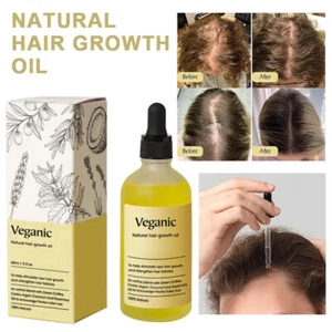 Natürliches Haarwachstumsöl Veganes organisches natürliches Haarwachstumsöl 60ML - Photo 1/19