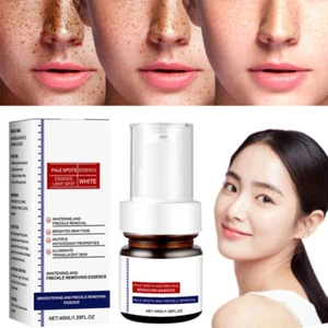 Crema sbiancante efficace lentiggini rimozione macchie scure crema rimozione melanina melasma - Foto 1 di 15