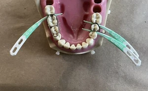 Dental Matrix Bands/ The U Dental Bands. Molars - Picture 1 of 6