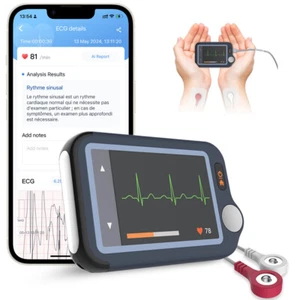 AI EKG ECG Monitor Bluetooth 30s/60s/5min Recording with free App & PC Software - Picture 1 of 15