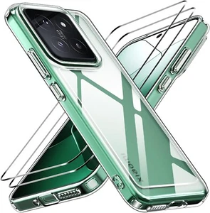 3in1 für Xiaomi 15 5G  2x Schutzglas 9H Panzerfolie Handy Hülle Case Hartglas - Bild 1 von 7