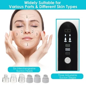 USB Rechargeable Hydrodermabrasion Device Vacuum Suction Facial Pore Cleaner MNJ - Picture 1 of 11
