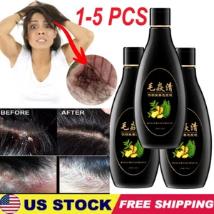 Kopfhaut Haar Follikel Shampoo Antibakteriell Anti-Juckreiz Milben Öl Kontrolle - USA 2025 - Bild 1 von 18