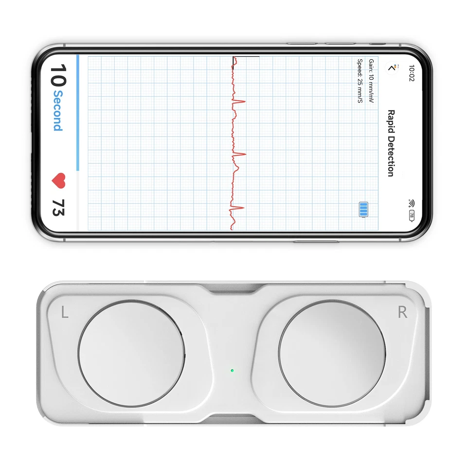 Smart Portable ECG Monitor - Rechargeable Heart Rate Tracker for Home Care - Image 1 of 4