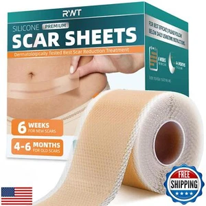 Silicone Scar Sheets, Silicone Scar Tape for Surgical Scars - 60" x 1.6" Roll - Picture 1 of 5
