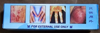 Fungal Infection Treatment Cream 10g. Skin Anti Fungus, For Itchy Skin.  - Image 1 of 4