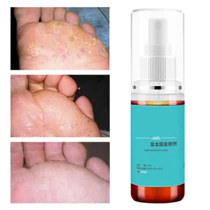 Spray para pies de atleta restaurar la salud de la piel 55 ml spray para pies diario para mujeres SG5 - Imagen 1 de 8