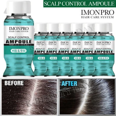 Nueva ampolla/tratamiento de proteínas para el cuidado del cabello de cuero cabelludo sólido para el cabello Foto 1 de 4