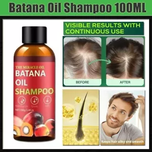 Hair Growth Shampoo Nourishing Roots Loss DHT Blocker Stop Alopecia! 100ml - Picture 1 of 11