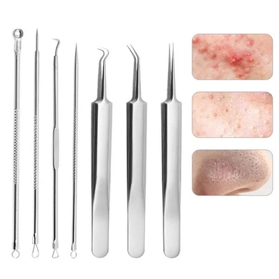 Blackhead Remover Stainless Needles Acne Comedone Pimple Extractor Remover Tool - Image 1 of 4