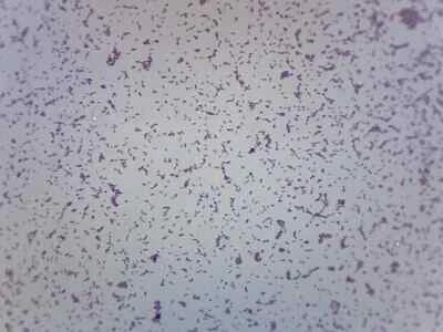 Shigella Dysenteriae - Mundial - Diapositiva preparada - 75x25 mm - Eisco Labs Foto 1 de 2