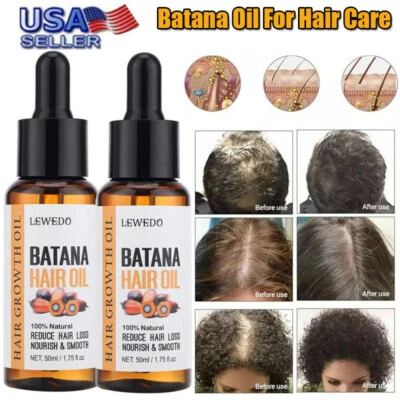 2PCS Organic Batana Oil - 50ml Natural Hair Growth Oil, Anti Hair Loss Treatment - Image 1 of 4