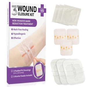 (3 CT) 2.3 X 2.3” Wound Closure Strips - Laceration Closure Kit - Zip Stitch ... - Imagen 1 de 8
