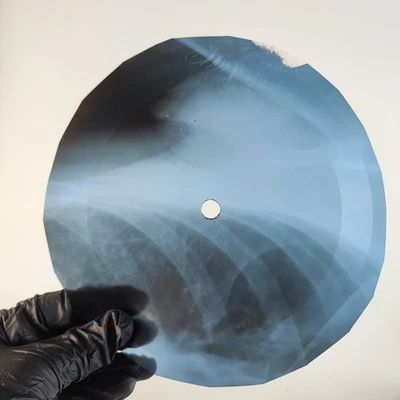 BOB DYLAN TELL ME THAT ISNT TRU X-Ray USSR Record Roentgen Bone Ribs Music Vinyl - Image 1 of 2