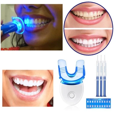 WHITESMILES Strong Teeth Whitening Kit Dental Tooth Whitener. Advanced Complete Full Kit