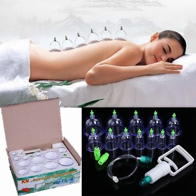 12 Cups Chinese Cupping Set Vacuum Suction Cups for Pain Relief Physical Therapy - Image 1 of 4
