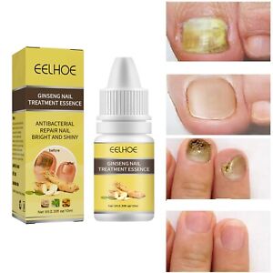 Nail And Toenail Fungus Treatment, Maximum Human Nail Grinders for Thick Nails