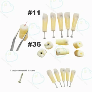 Dental #11 #36 Vitro Dientes Caries Tornillo Modelo Dentista Herramienta de Enseñanza de Dientes - Imagen 1 de 9