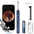 Ear Wax Removal Tool with Camera:Bebird Note 5 Ear Cleaner with Otoscope and ...