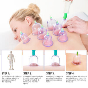 Medical Chinese Body Vacuum Cupping Healthy Suction Therapy Massage 12 Cups/set