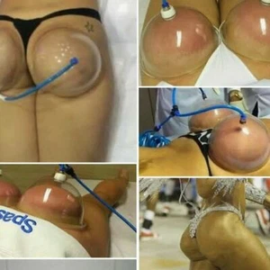 Buttocks Enhancement Pump Lifting Vacuum Cupping Suction Therapy Device - Bild 1 von 6