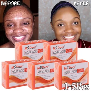 1-5PCS Turmeric Kojic Acid Soap for Acne Dark Spots Remove Skin Whitening 100g - Picture 1 of 31
