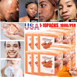 10x Tumeric Soap Skin Whitening Dark Spots lightening Acne Brightening Turmeric - Picture 1 of 21