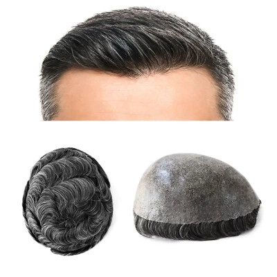Peluca de repuesto de sistema de cabello humano PU inyectada con toupee de piel de polietileno completa para hombre Foto 1 de 4