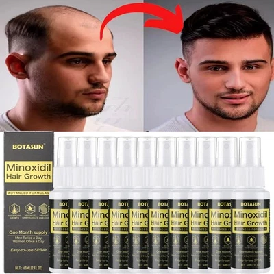 Minoxidil 5% Extra Strength for Men Hair Regrowth Treatment Topical Solution AU - Image 1 of 4