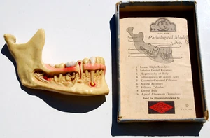 Antique 1925 Dentistry Display Dental Specialty Jaw Teeth Dentist Pathological - Picture 1 of 15