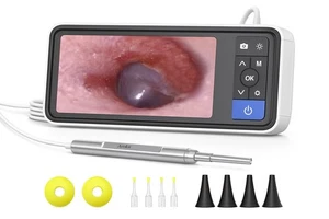 Anykit Digitales Otoskop mit Gyroskop, 4,5 Zoll Bildschirm, 3,9 mm Ohrfernrohr Kamera - Bild 1 von 5