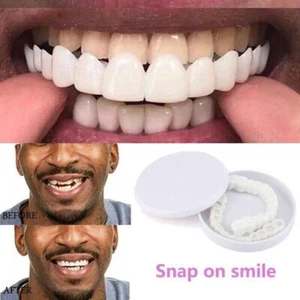 Snap on Upper Lower False Teeth Dental Veneers Dentures Fake Tooth Cover Set Usa - Picture 1 of 17