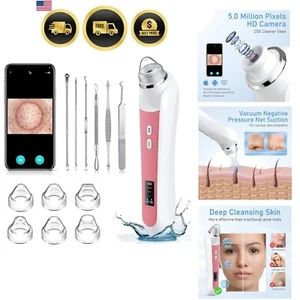 Blackhead Remover Vacuum Pore Cleaner With HD Camera USB Rechargeable - Picture 1 of 8