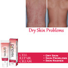 Natural Skin Treatment For Eczema Relief Psoriasis Skin Rashes Deep Moisturizer