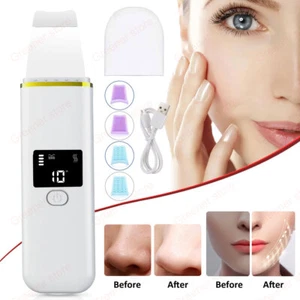 LCD Skin Scrubber Blackhead Peeling Remover Facial Face Care Pore Deep Cleaning - Picture 1 of 17