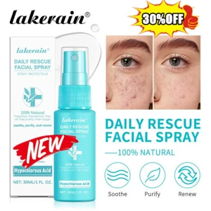 Hypochlorous Acid Spray Face, Daily Res-cue Facial Spray 30ml - Picture 1 of 16