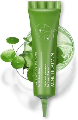 BRANDED Centella Strong Acne Removal Cream Anti Acne Pimples Scars Spots Clean Anti-Bac