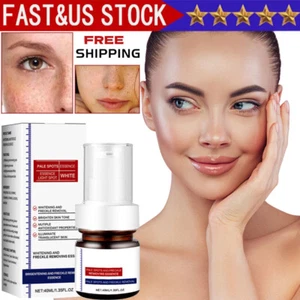 2pc Whiting And Freckle Removing Serum Cream Dark Spot Removing Freckle Essence - Picture 1 of 17
