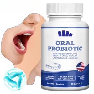 Oral Probiotic Support Healthy Teeth and Gums (60 Capsules) - Picture 1 of 6