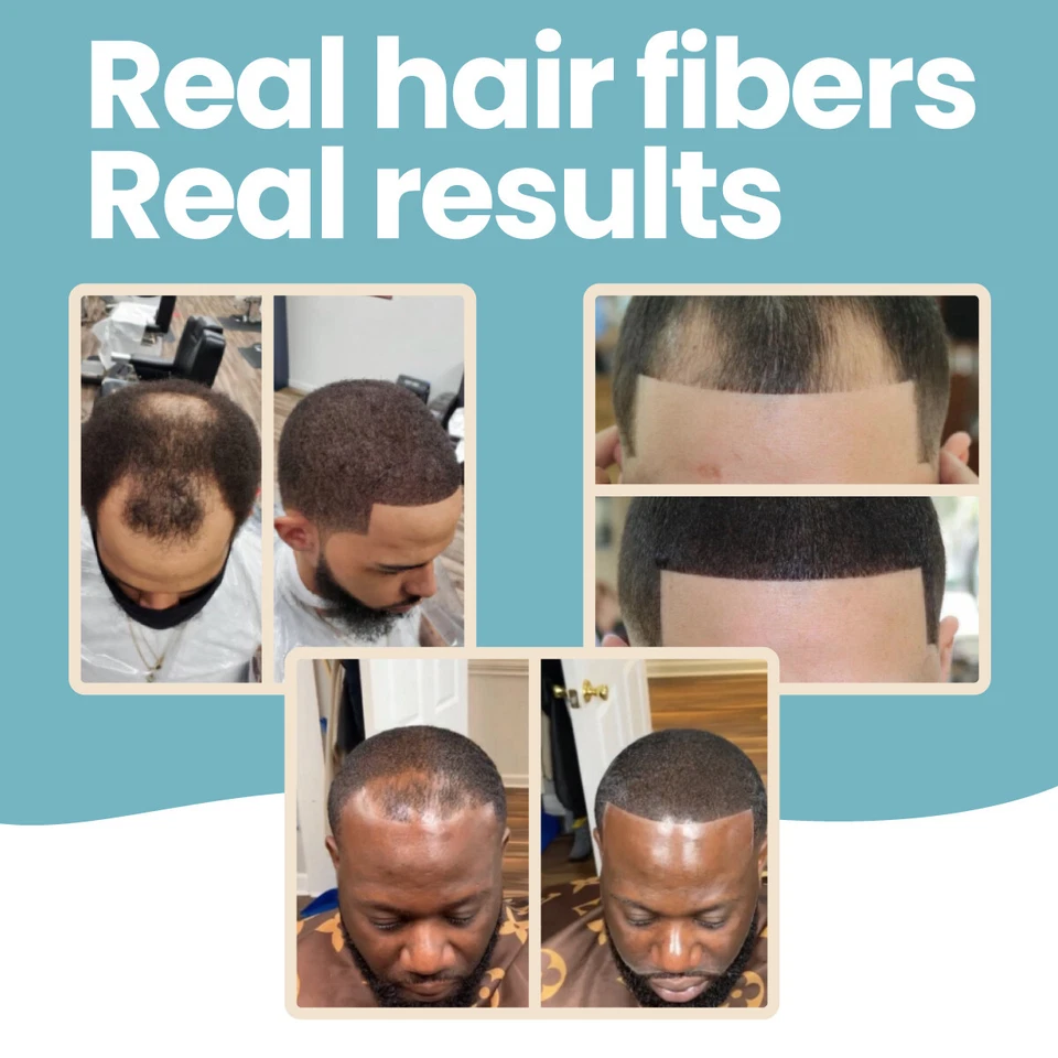 Hair Loss Concealer Fibers - Barber Shop Beauty Parlour Salon Equipment Supplies - Image 1 of 4