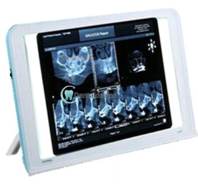 Pelicula Dental Radiologia Rayos x Lector LED Iluminado Turística de Montaje - Imagen 1 de 3