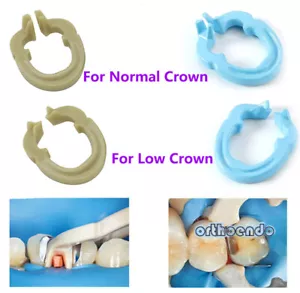 Dental Sectional Contoured Metal Matrix Bands Resin Refill Separating Clamp Ring - Picture 1 of 14