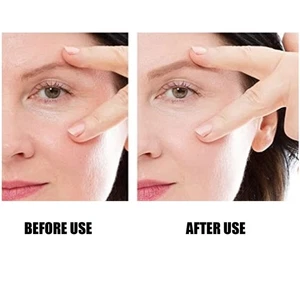 20pcs/sheet Reusable Wrinkle Patches Home Skin Tightening Eliminate Wrinkles NAU - Picture 1 of 24