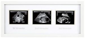 Triple Baby Scan Ultrasound Photo Frame Baby Shower Keepsake Baby Birth Gifts