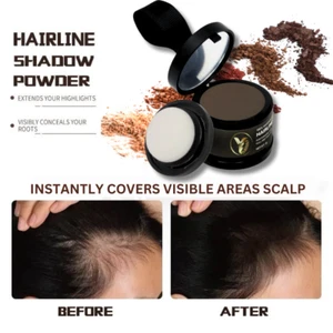 Hair Powder Cover Up Hairline Shadow Instant Concealer 🔥 BUY 3 GET 1 FREE 🔥 UK - Picture 1 of 5