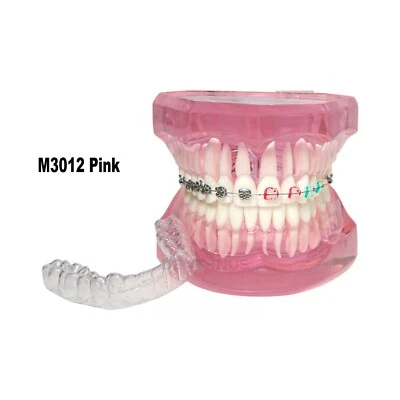 Dental Teaching Model Orthodontic With Retainer Metal Ceramic Bracket Demo M3012 - Image 1 of 4