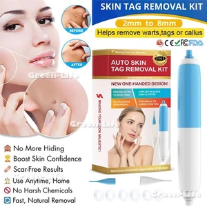 2in1 Painless Auto Mole Wart Removal Skin Tag(40x Rubber Bands +10x Alcohol Pad) - Picture 1 of 12